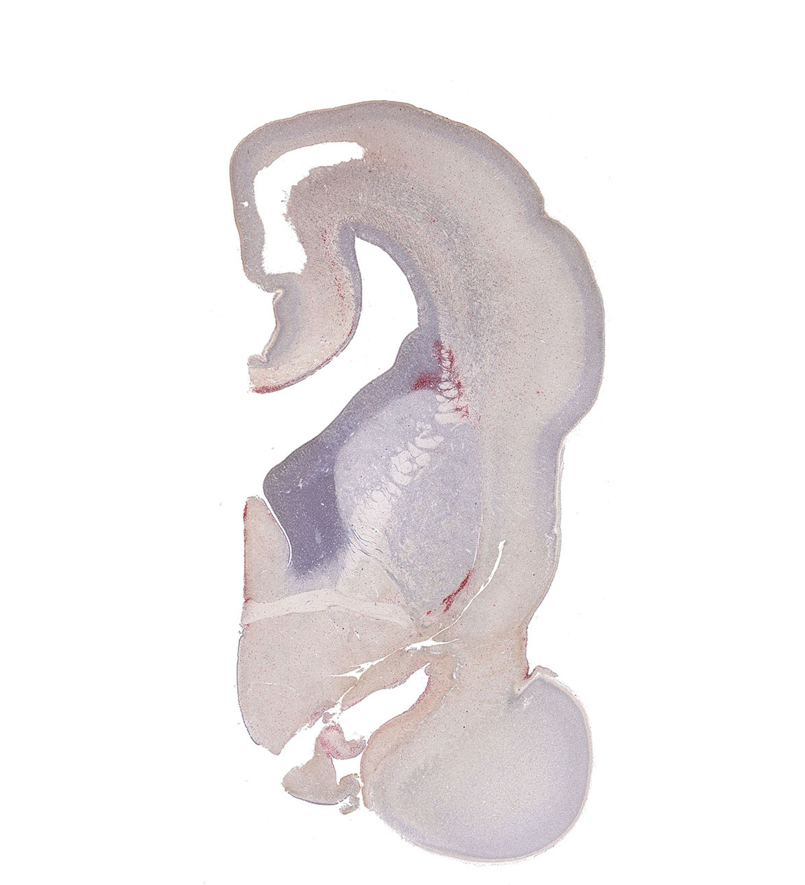 17PCW Human fetal brain