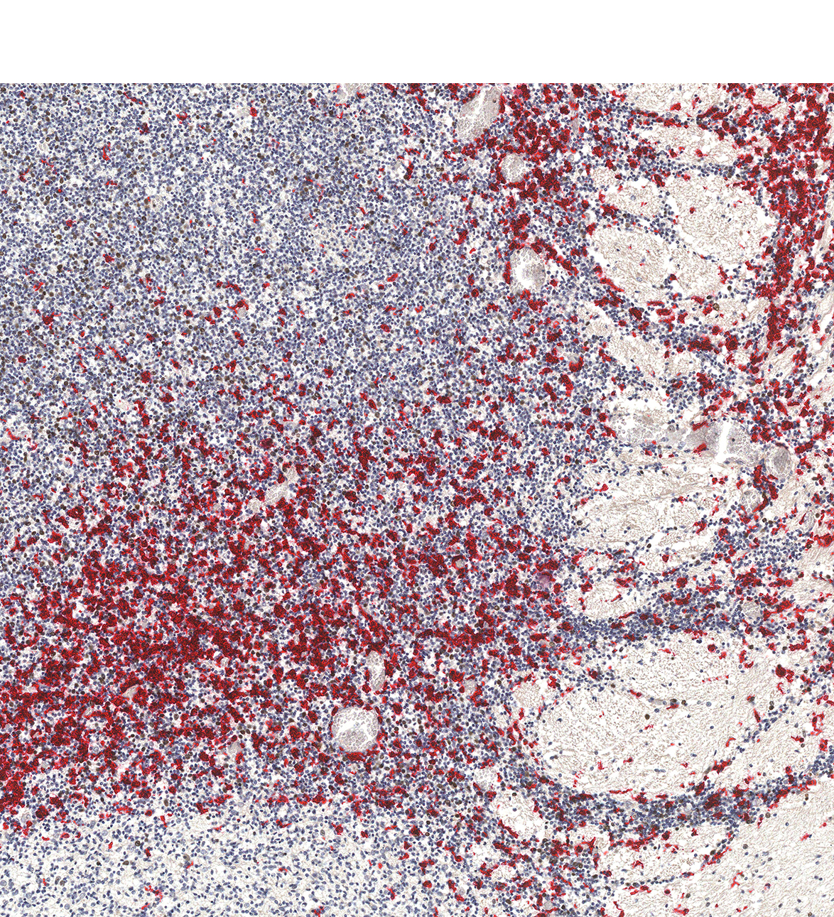 17PCW Human fetal brain