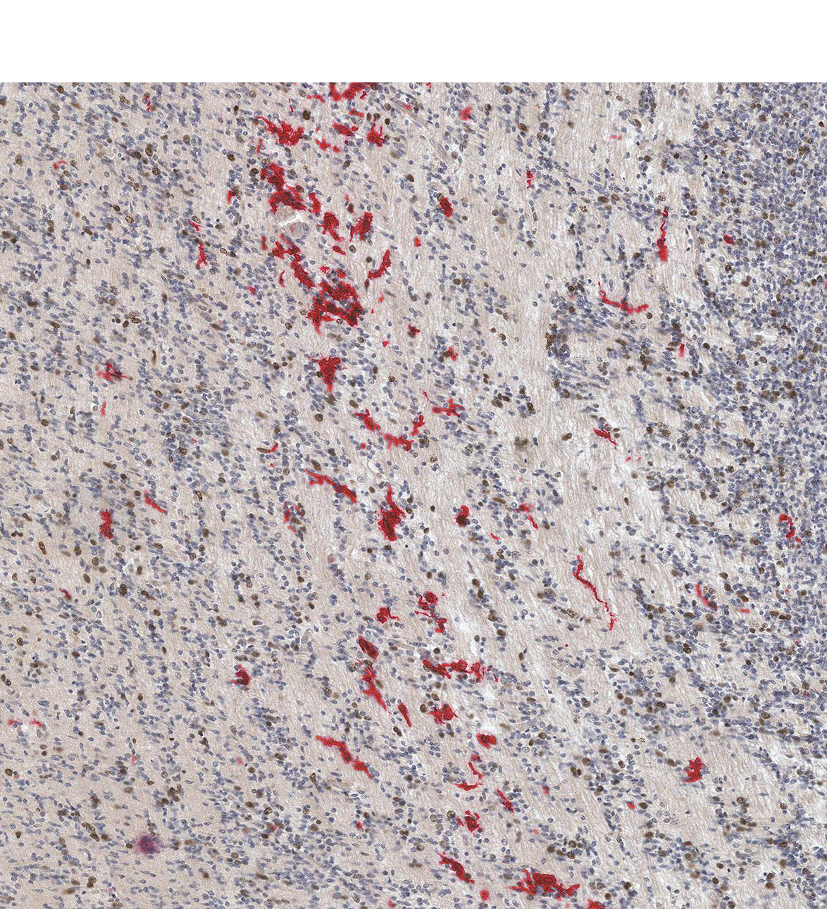 17PCW Human fetal brain