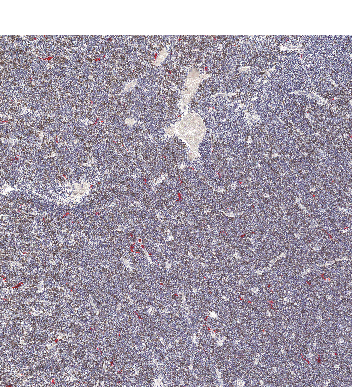 17PCW Human fetal brain