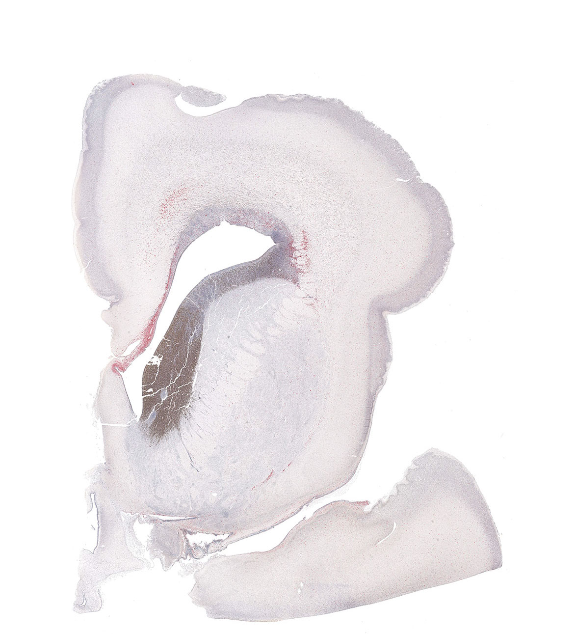 19PCW Human fetal brain