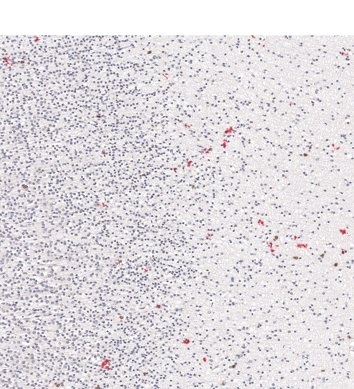19PCW Human fetal brain