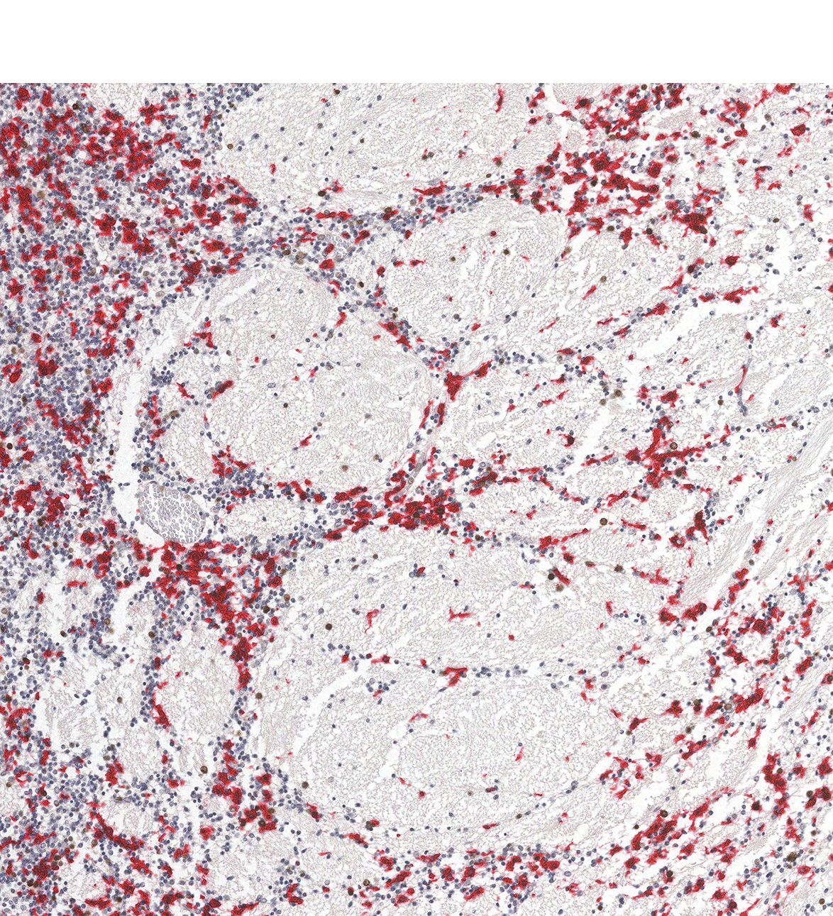 19PCW Human fetal brain