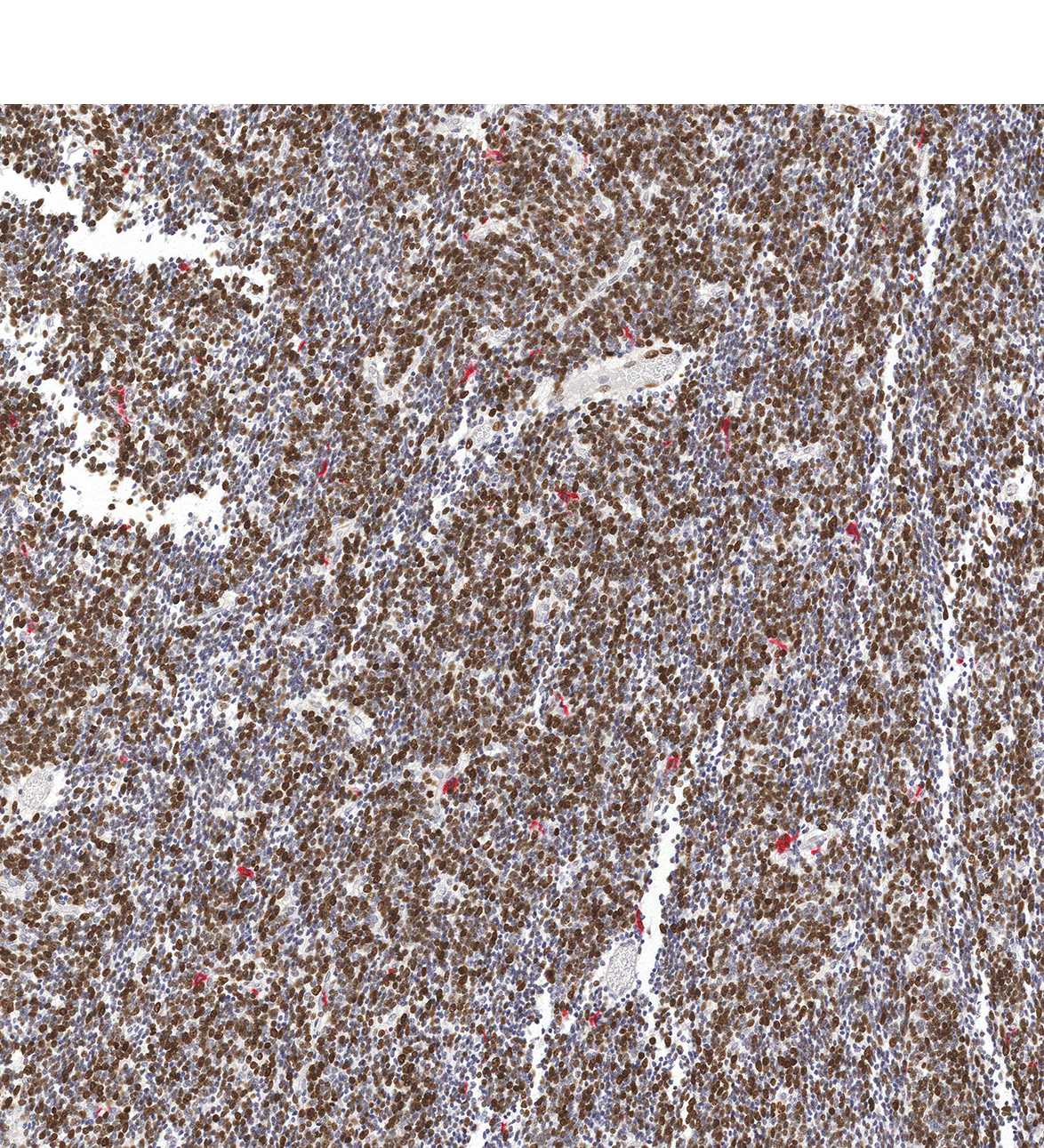 19PCW Human fetal brain