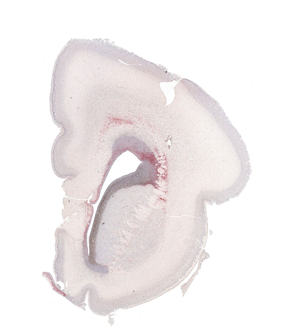 20PCW Human fetal brain