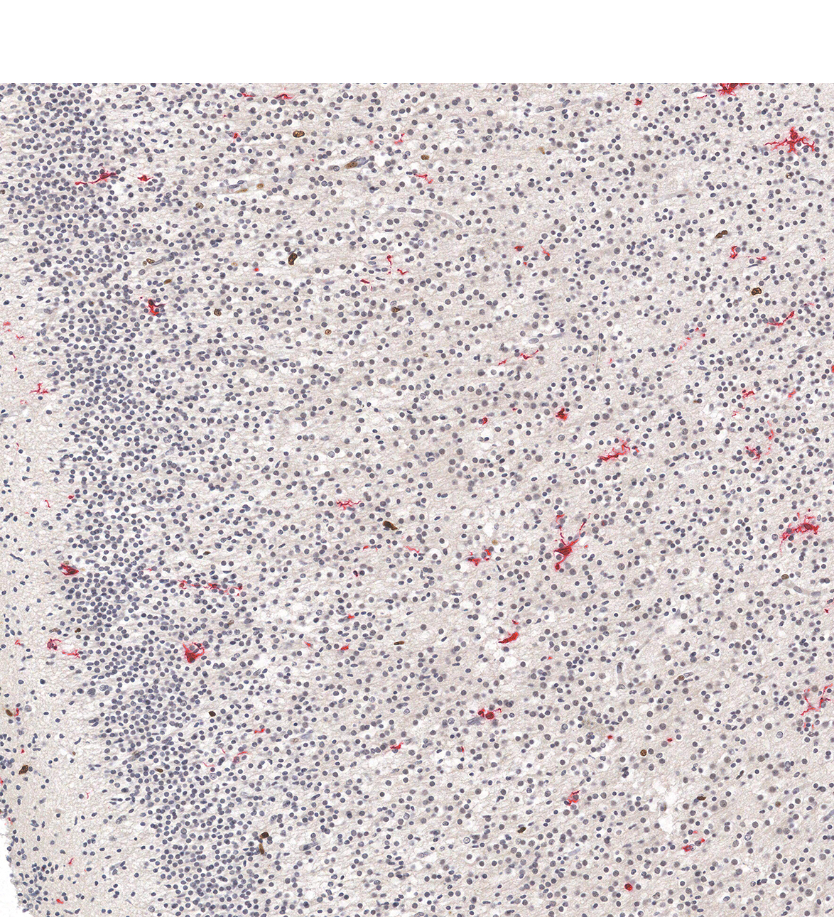 20PCW Human fetal brain