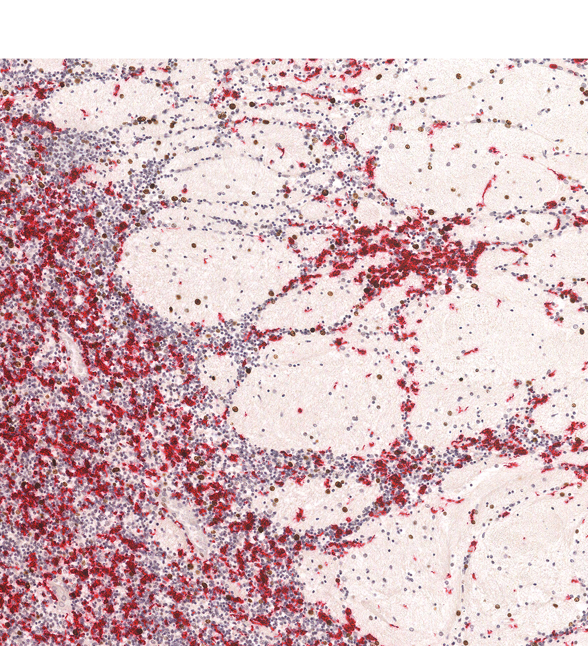 20PCW Human fetal brain