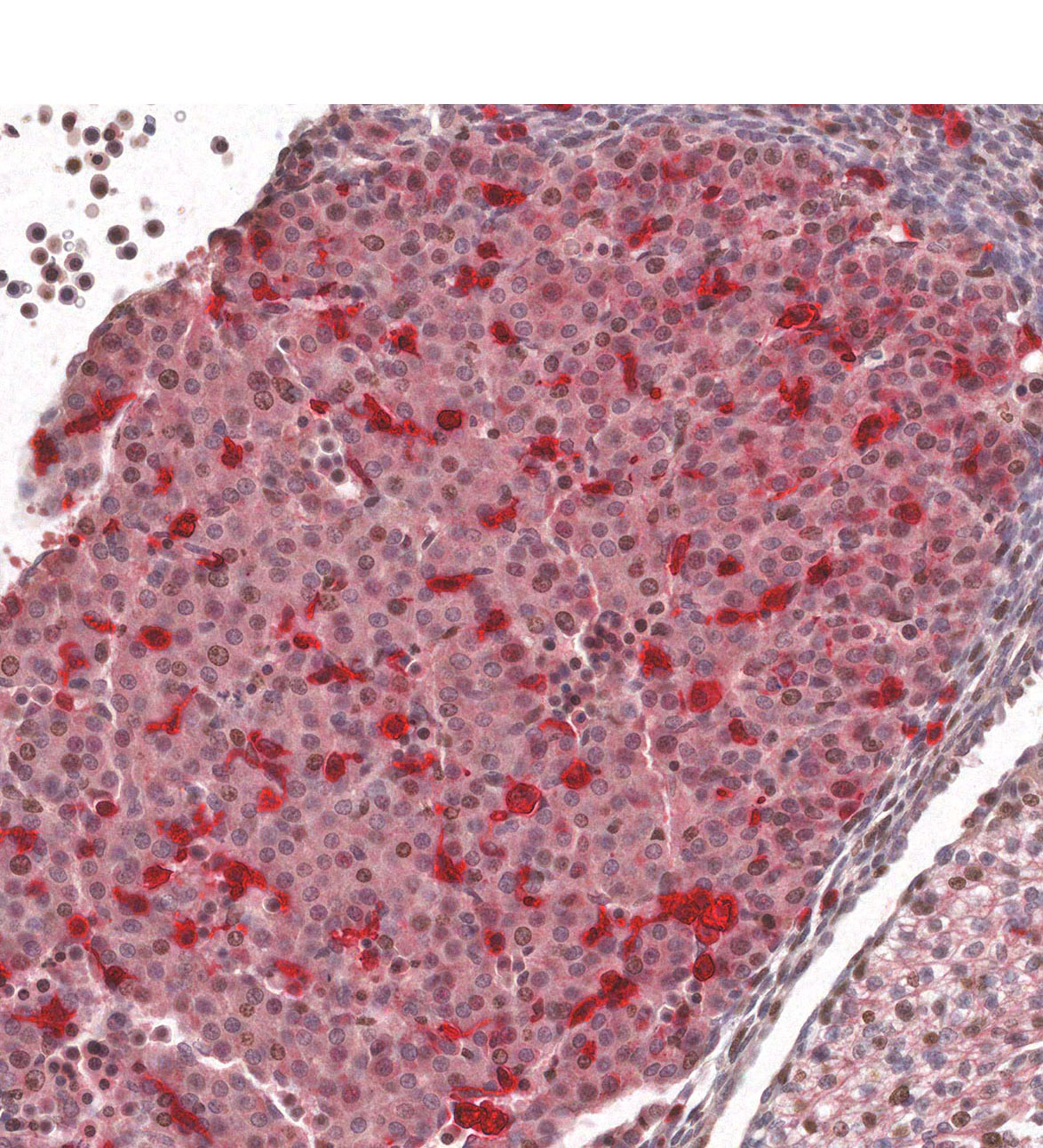 CS14 Human embryo