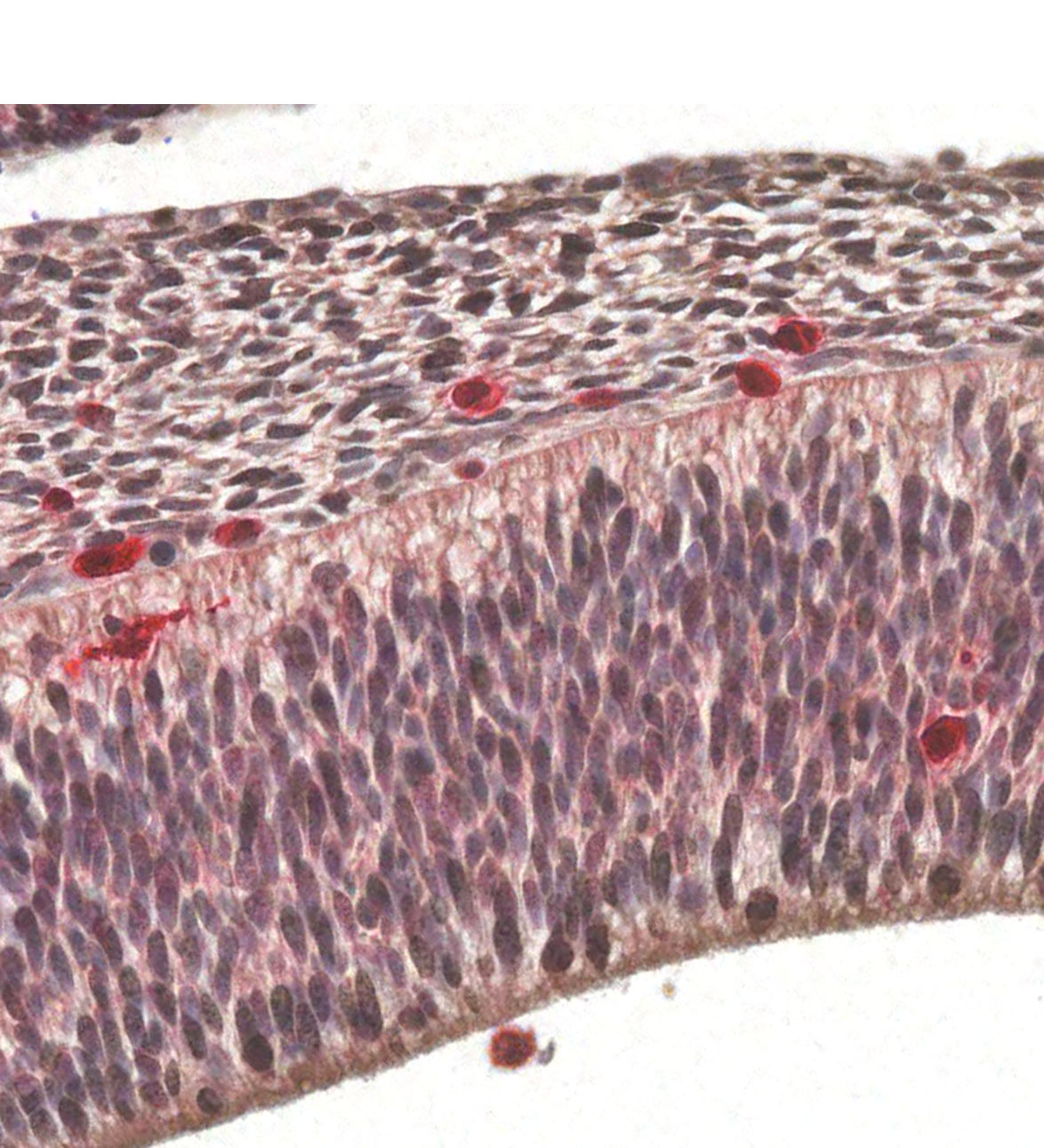 CS14 Human embryo