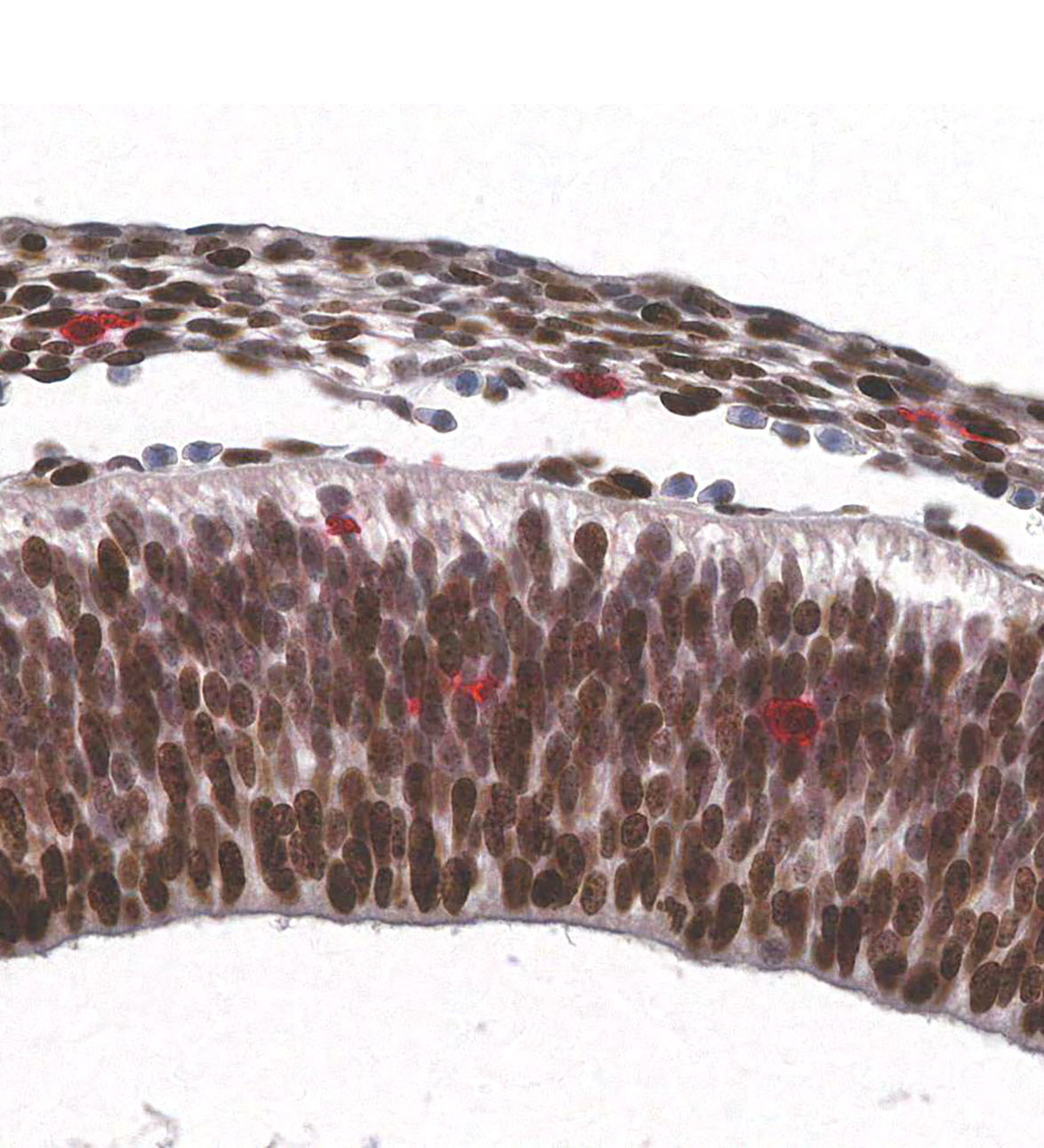 CS16 Human embryo