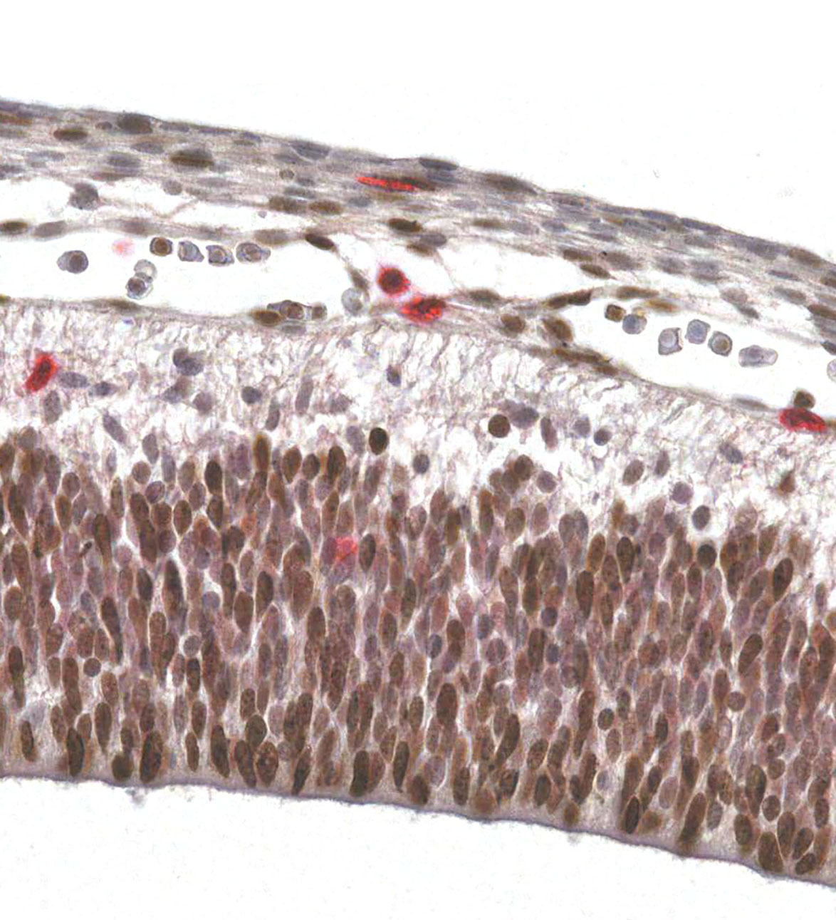 CS18 Human embryo