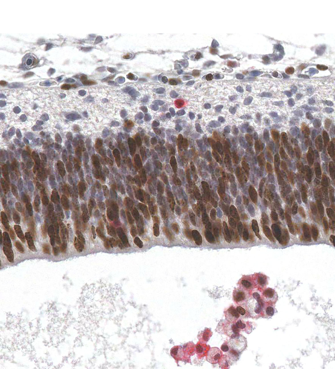 CS21 Human embryo