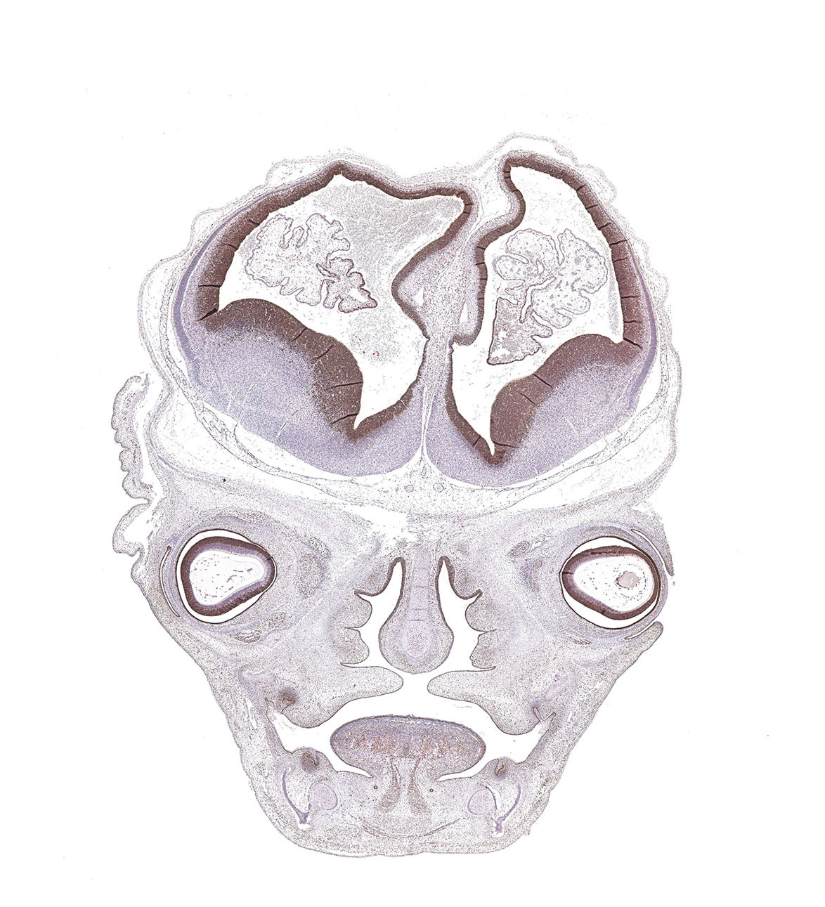 CS23 Human embryo