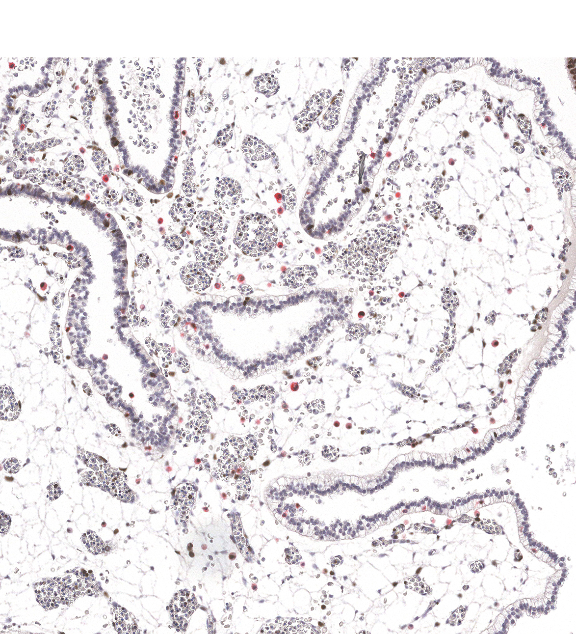 CS23 Human embryo