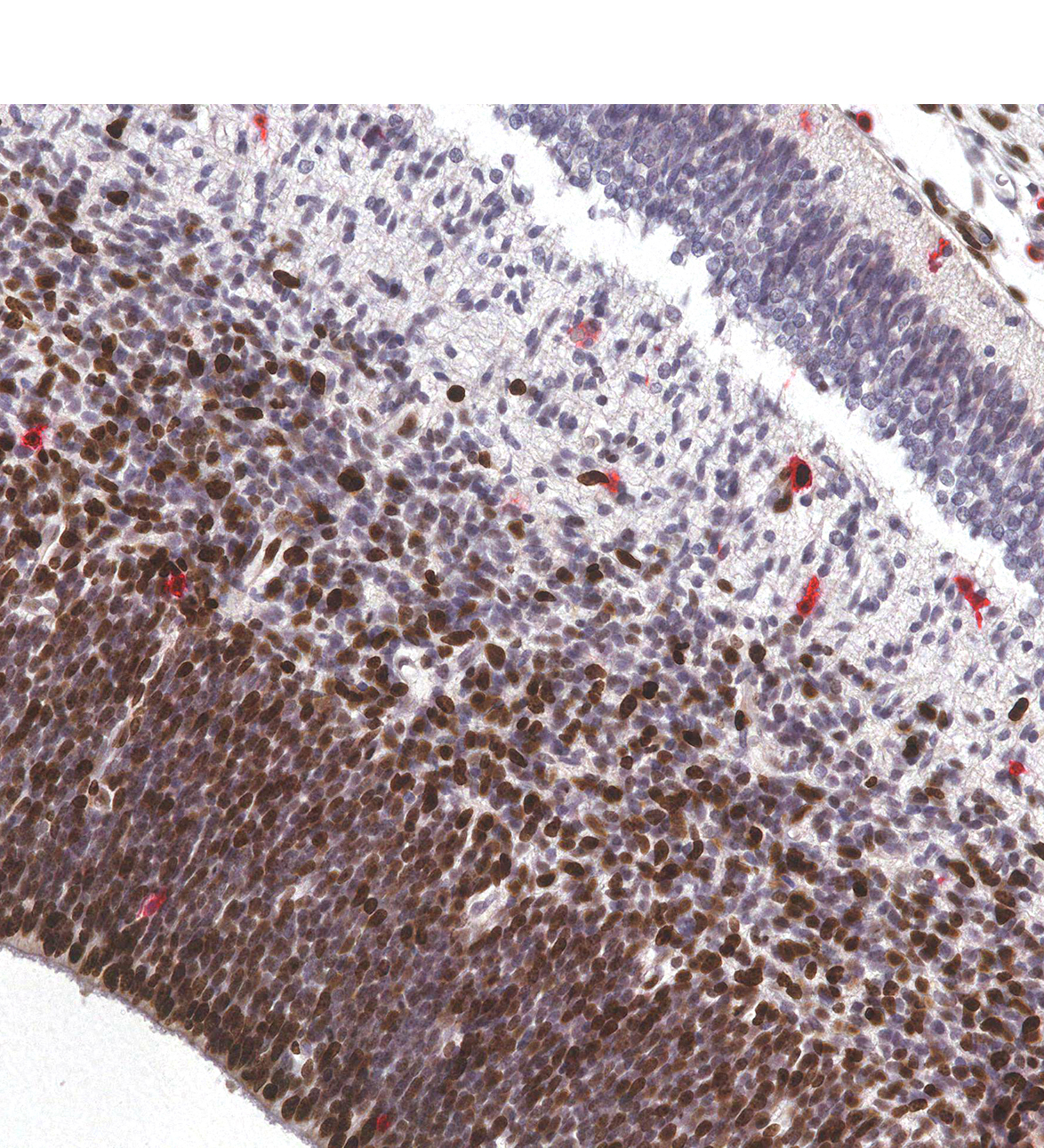 CS23 Human embryo