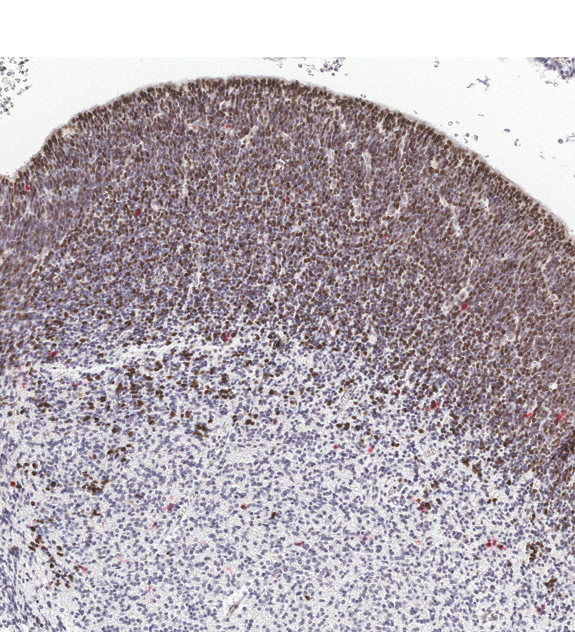 CS23 Human embryo