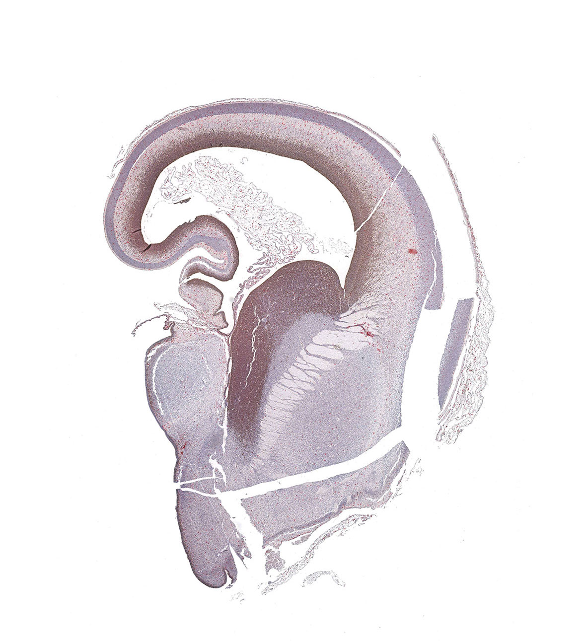 10PCW Human fetal brain