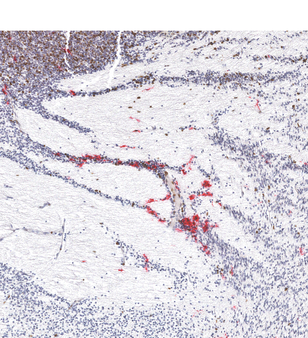 10PCW Human fetal brain