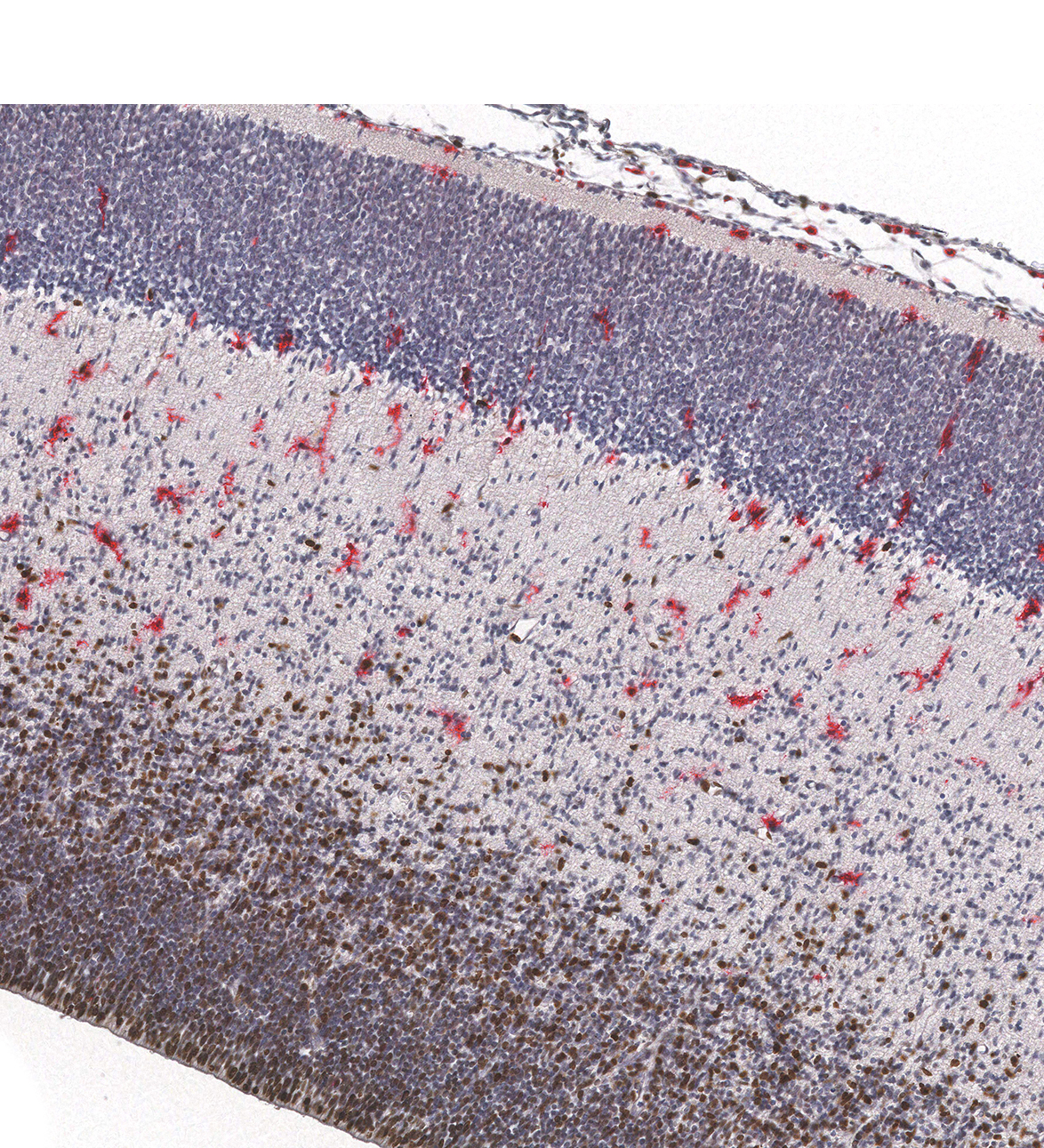 10PCW Human fetal brain