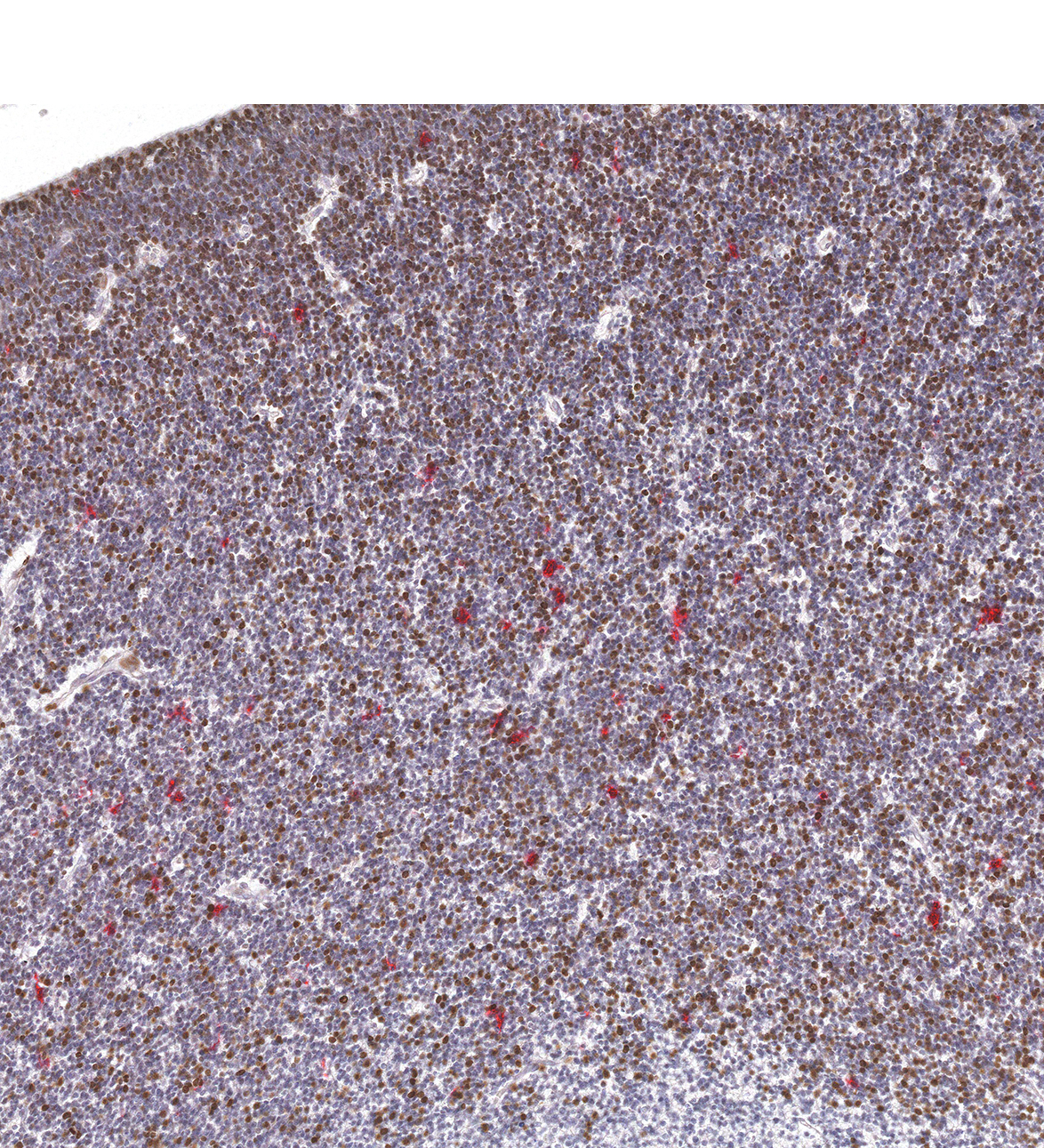 10PCW Human fetal brain