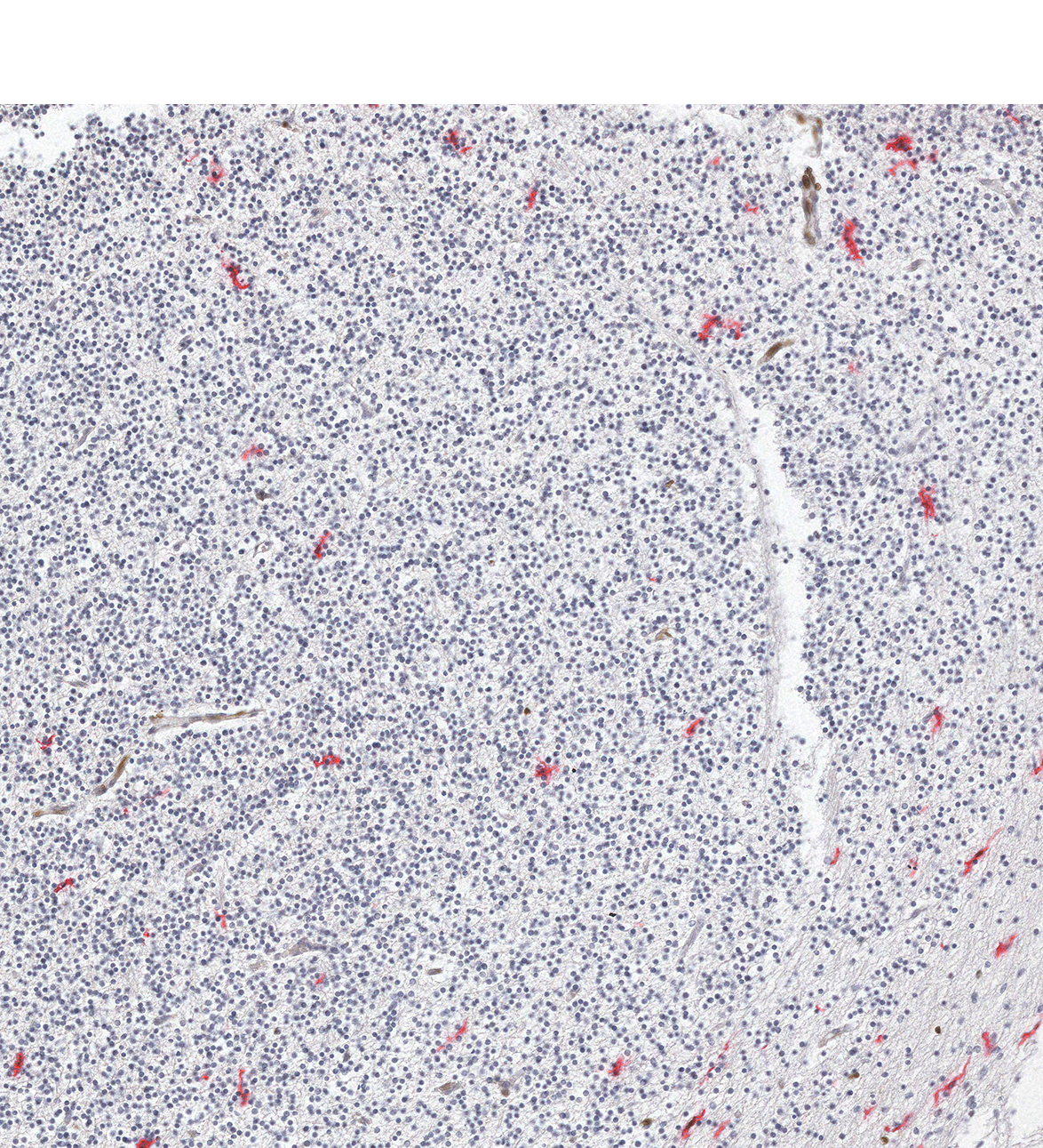 10PCW Human fetal brain