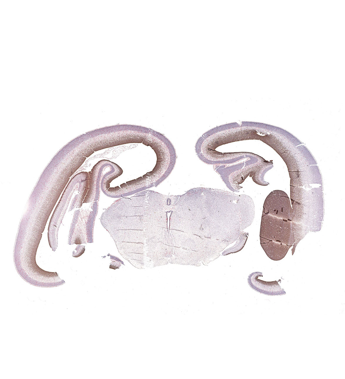 12PCW Human fetal brain