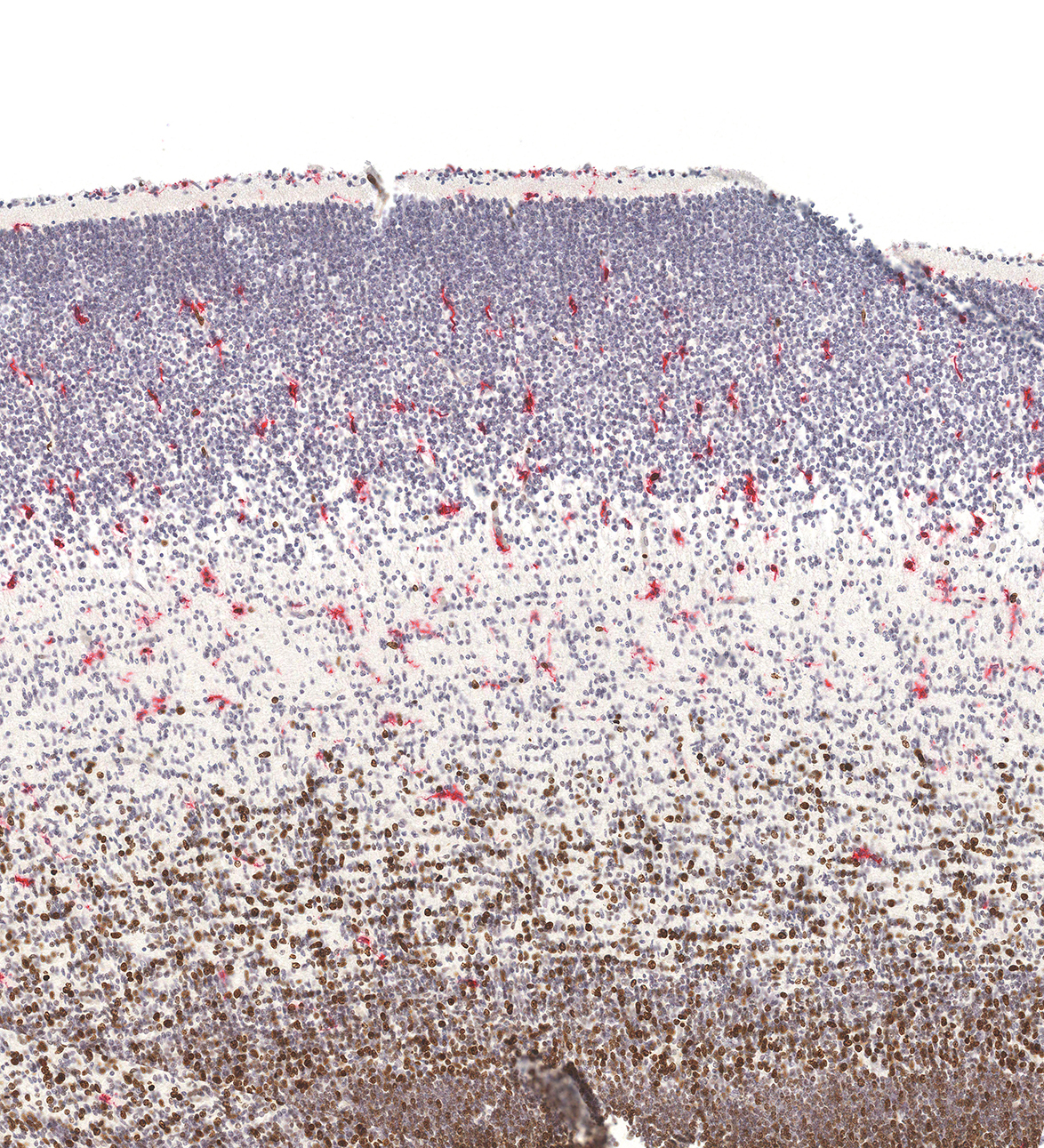 12PCW Human fetal brain