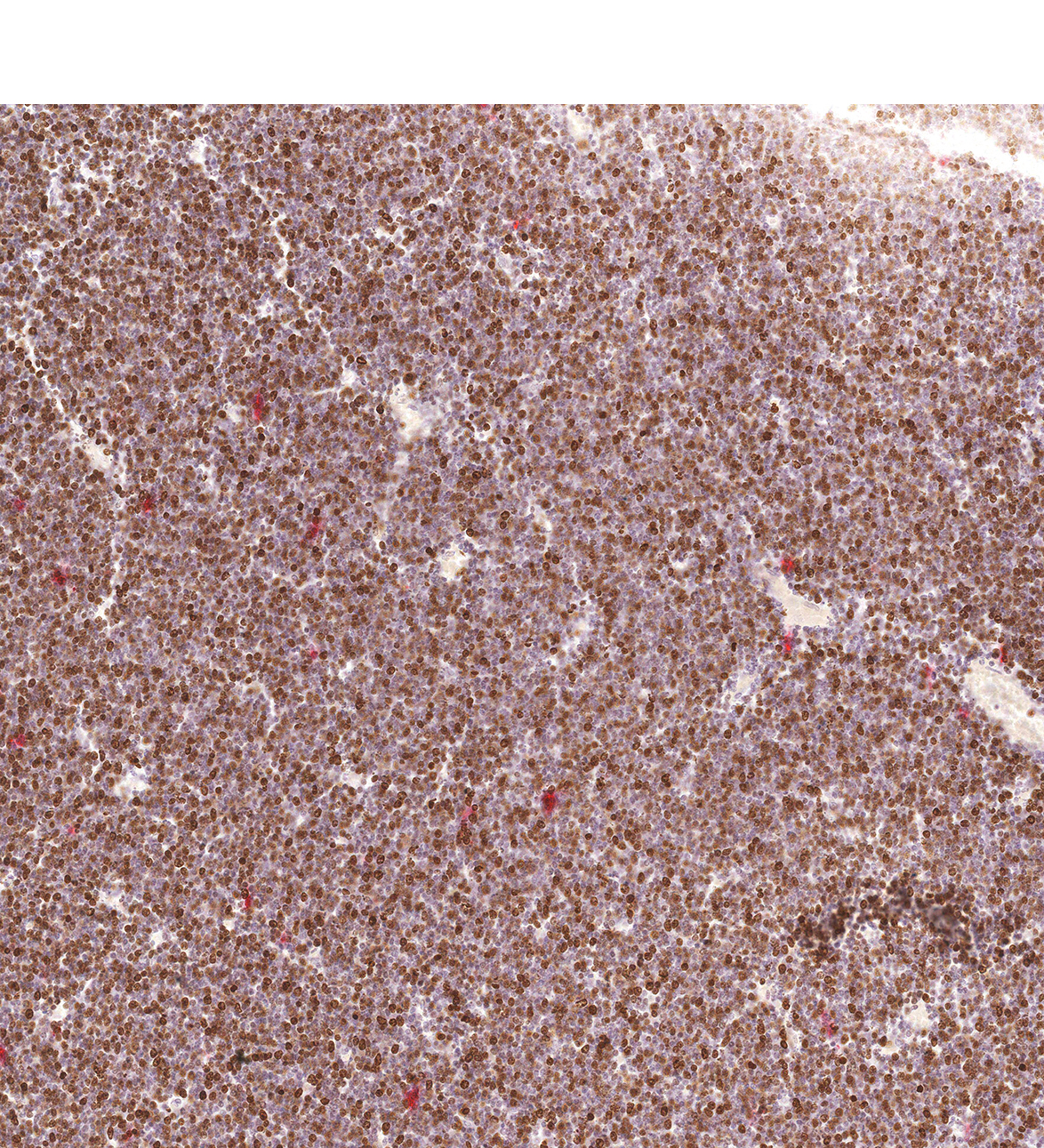 12PCW Human fetal brain