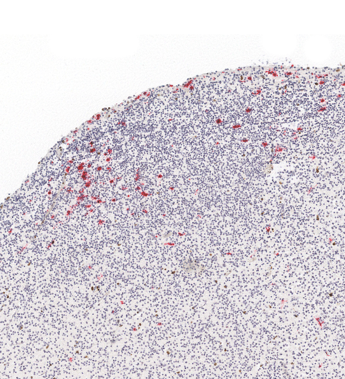 12PCW Human fetal brain