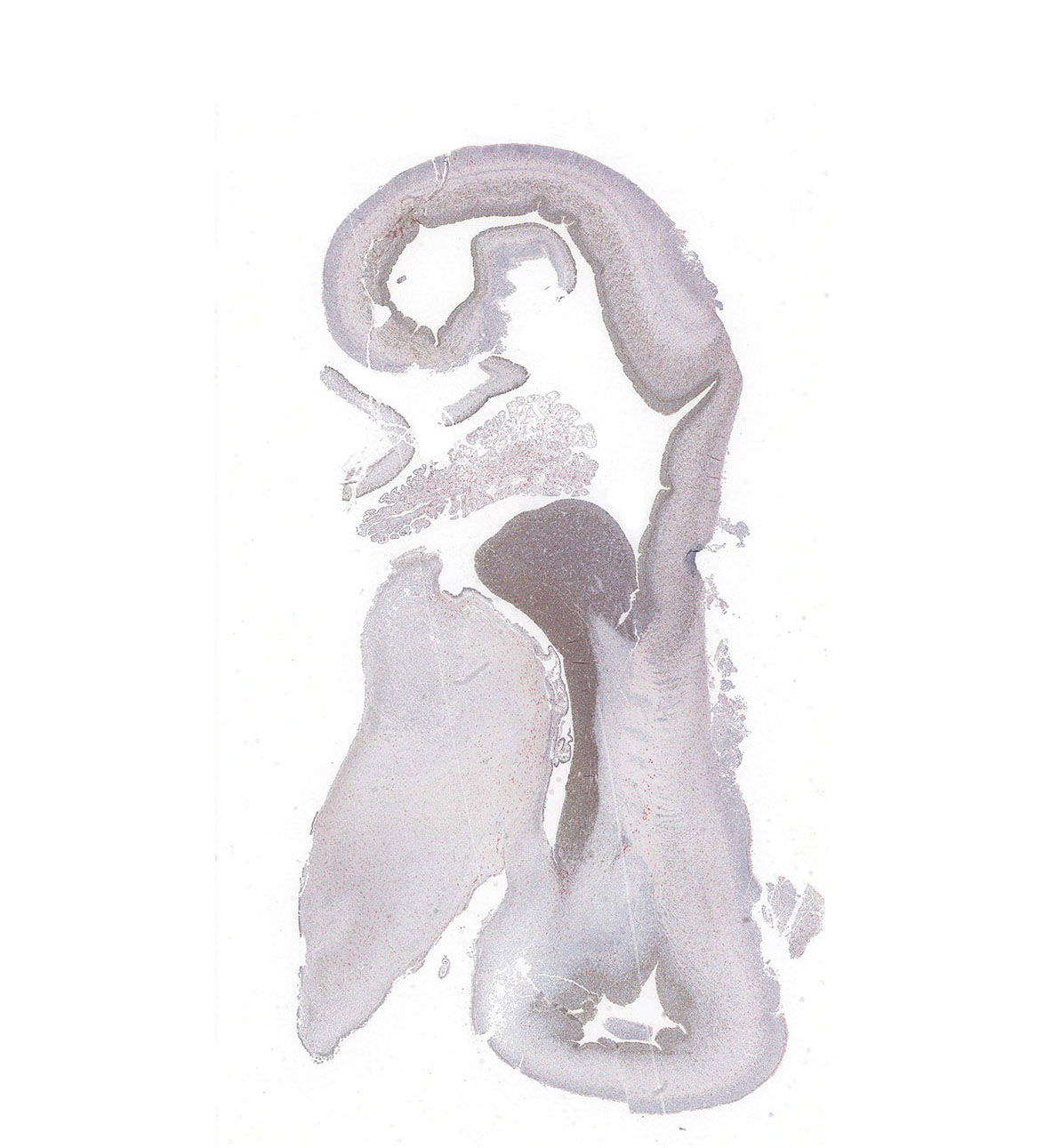 12PCW Human fetal brain