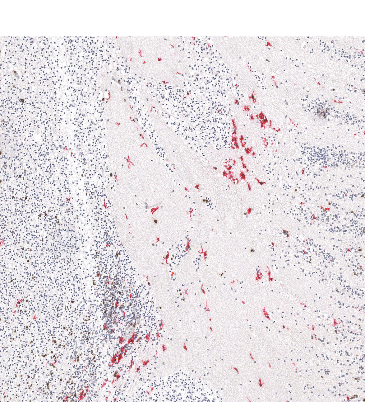 12PCW Human fetal brain