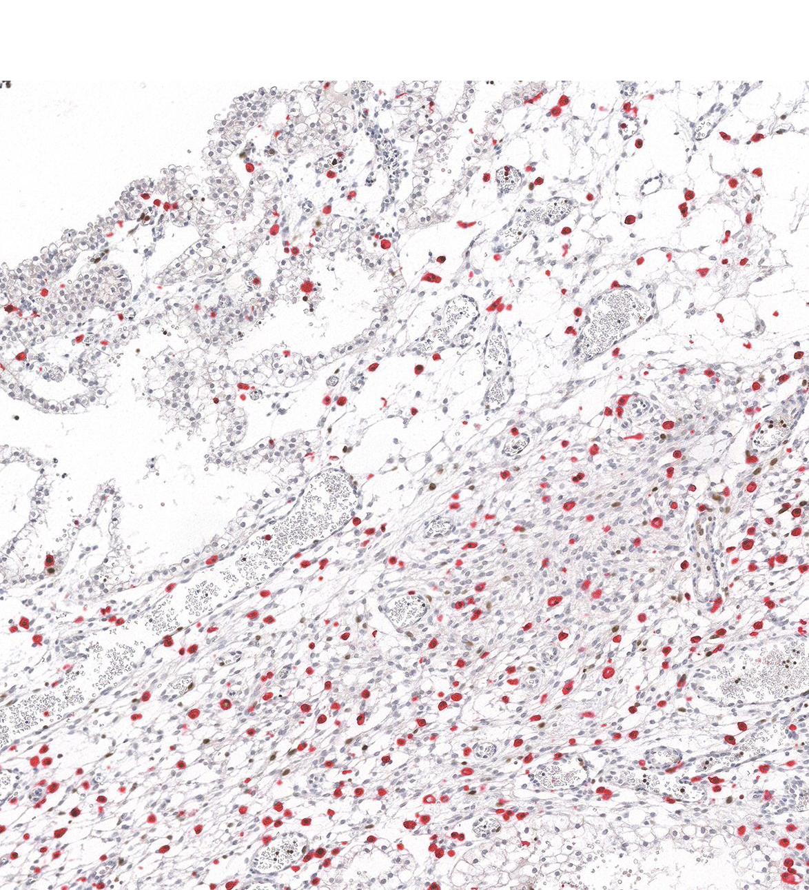12PCW Human fetal brain
