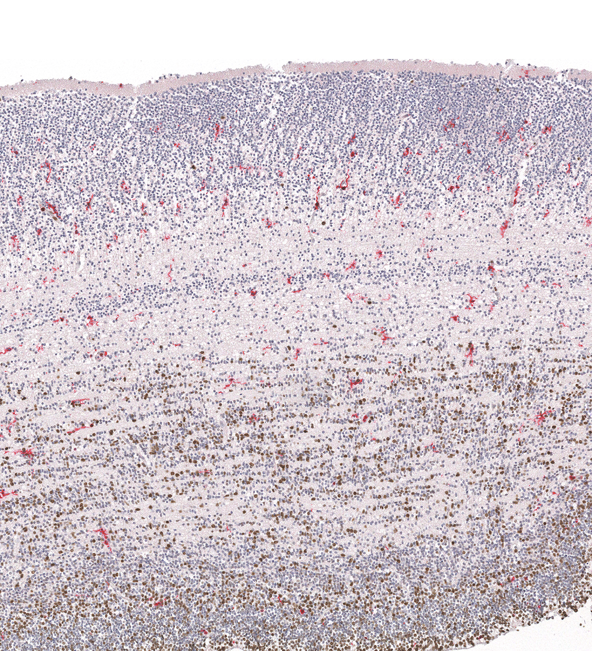 12PCW Human fetal brain
