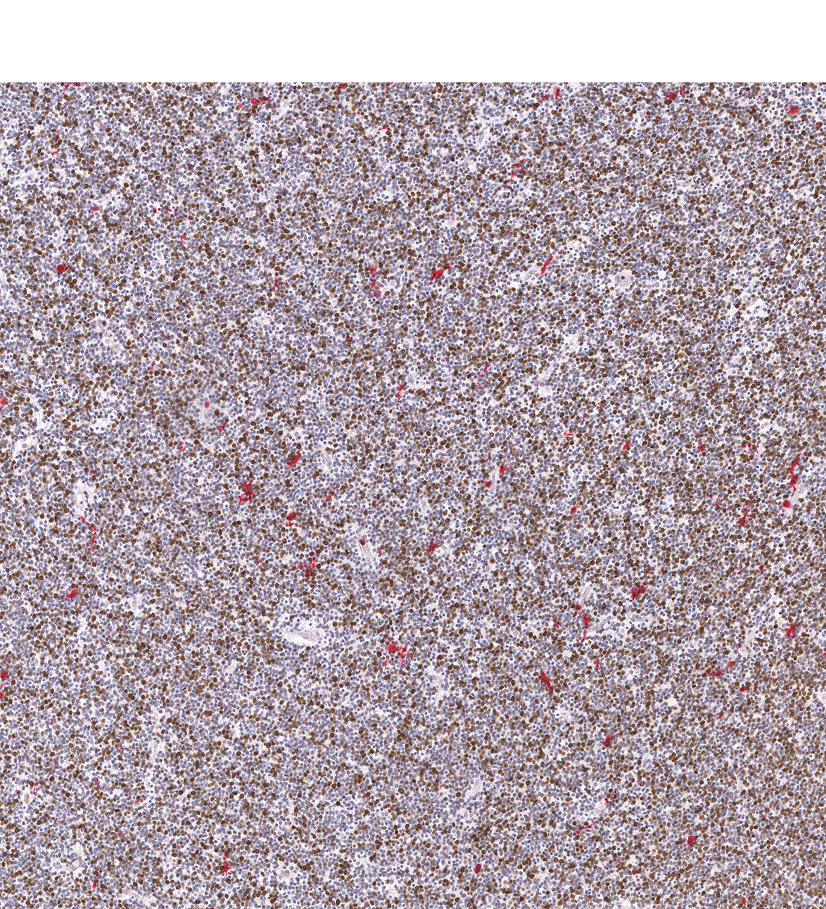 12PCW Human fetal brain