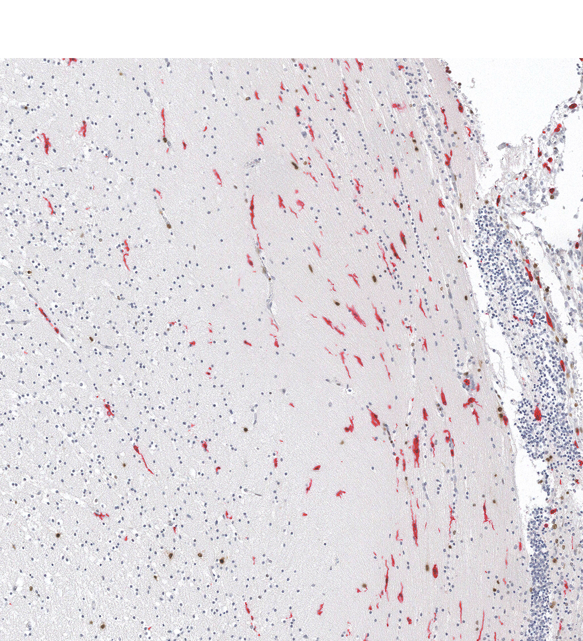 12PCW Human fetal brain