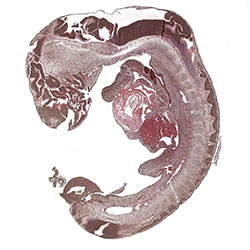 CS12 immunohistochemistry