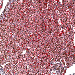 CS12 immunohistochemistry
