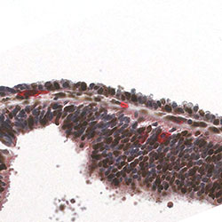 CS12 immunohistochemistry