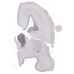 17pcw immunohistochemistry