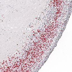 17pcw immunohistochemistry