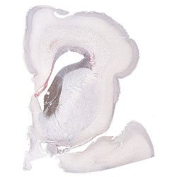 19pcw immunohistochemistry