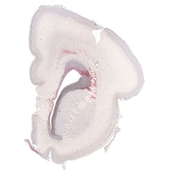20pcw immunohistochemistry