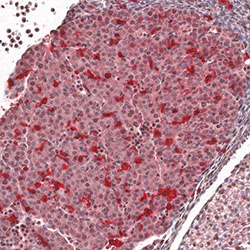 CS14 immunohistochemistry