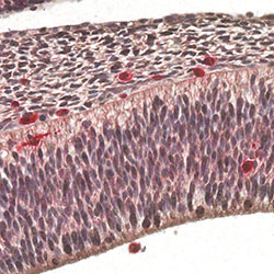 CS14 immunohistochemistry