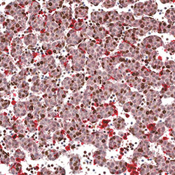 CS16 immunohistochemistry