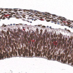 CS16 immunohistochemistry
