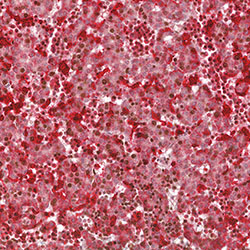 CS18 immunohistochemistry