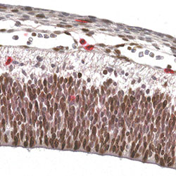 CS18 immunohistochemistry