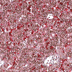 CS21 immunohistochemistry