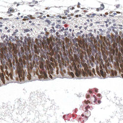 CS21 immunohistochemistry